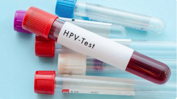 10 địa chỉ xét nghiệm HPV ở đâu uy tín nhất Hà Nội